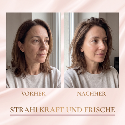 Aivelore Gesichtsserum mit Lifting-Effekt